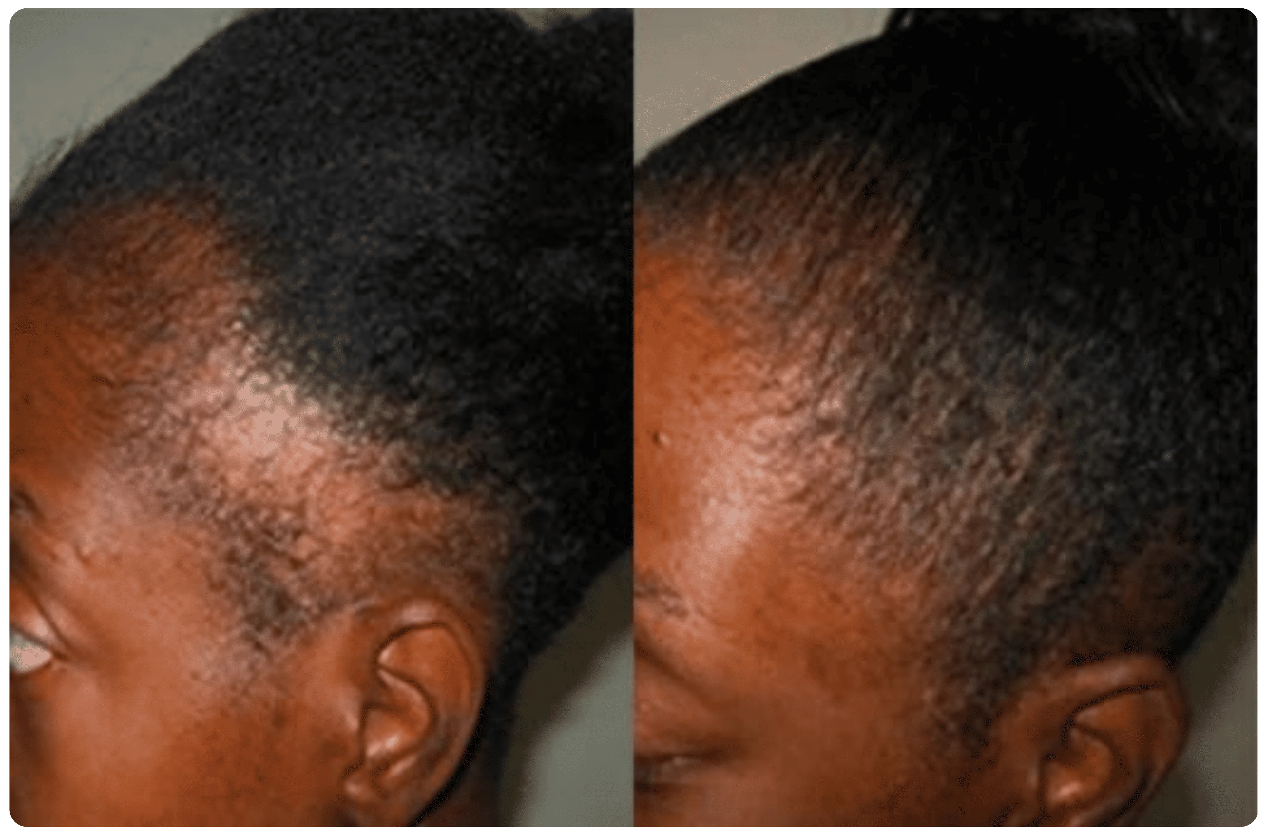 Transform Your Hair, Transform Your Confidence!